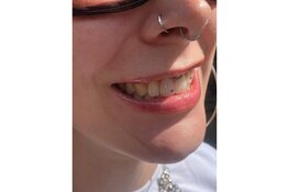 Nieuw bij Kingdom Tattoo & Piercing Alkmaar: Toothgems